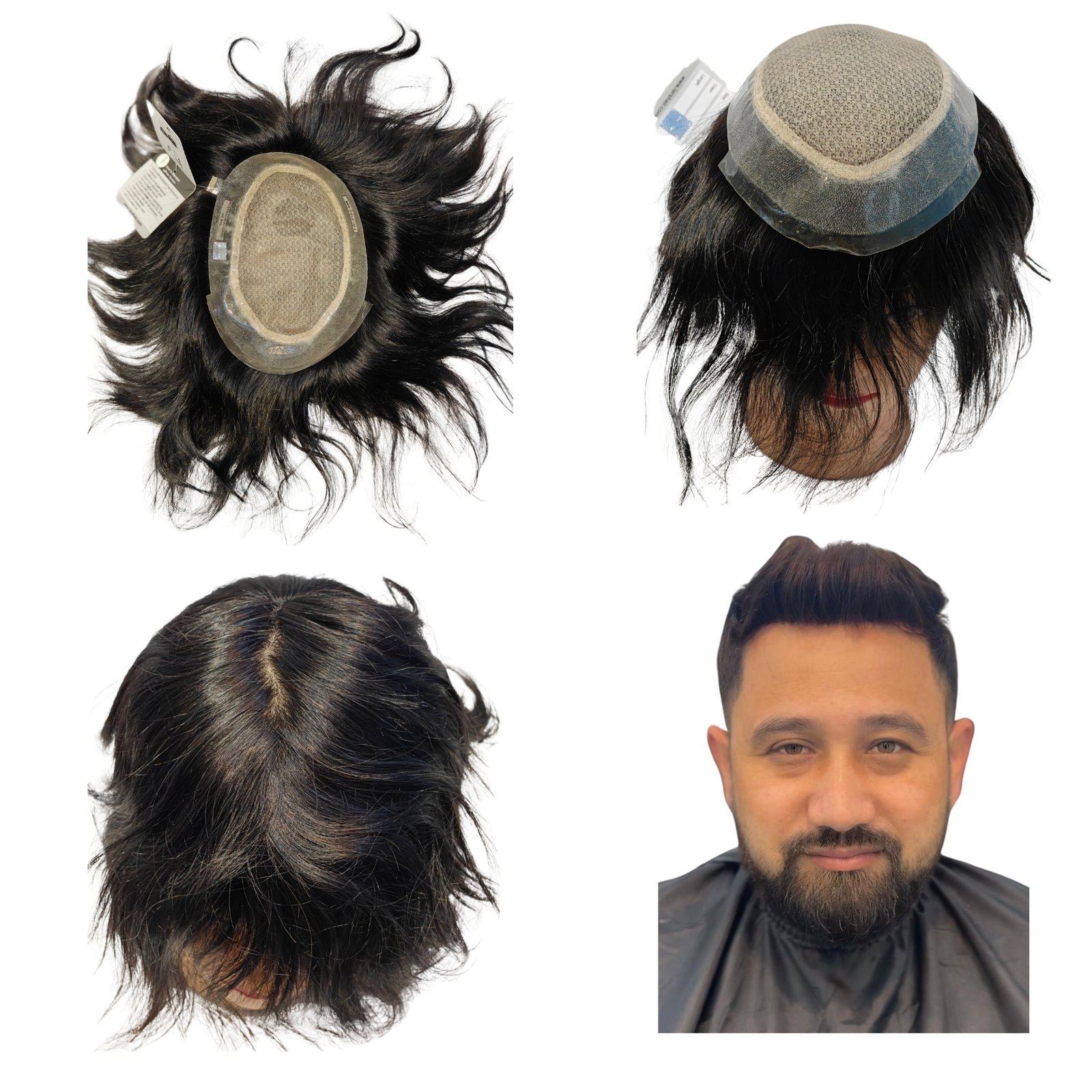 Men's Hair Patch