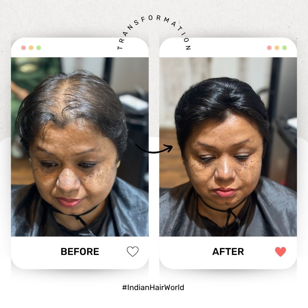 Best Hair Patch Service in Kolkata